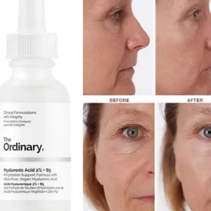 The Ordinary Hyaluronic Acid 2% + B5 30ml